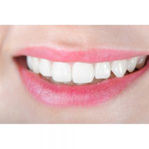 SG2292 happy smile lady woman teeth