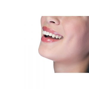 SG2563 woman smiling teeth