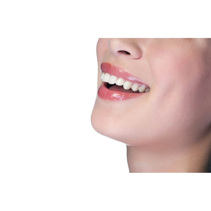 SG2563 woman smiling teeth